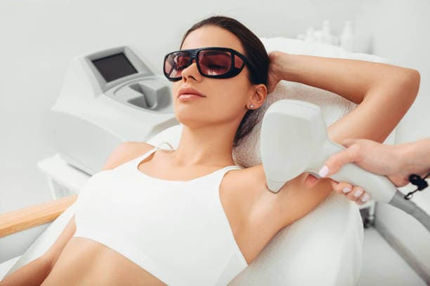 Depilacion laser